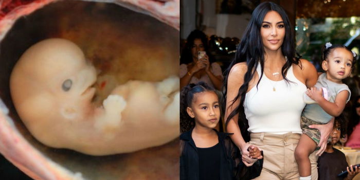 Jangan LASAK Sangat Di Awal Kehamilan, Kim Kardashian Juga Hampir Keguguran Di Trimester Satu