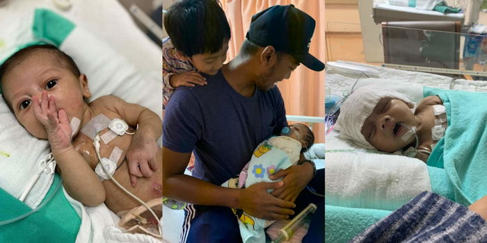 Bayi Tak Berak 48 Jam Selepas Lahir Kerana Usus Gagal Berfungsi, Kini Pergi Buat Selamanya...