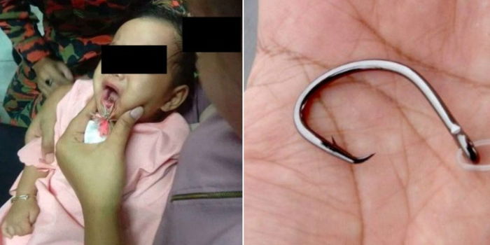 Hati-Hati Ayah Kaki Memancing, Budak Ini Tertelan Mata Pancing Yang Disangka Makanan