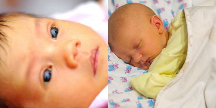 Ibu Jangan Berlengah Jika Mata Bayi Kuning, Ia Petanda Gejala Penyakit Yang Serius