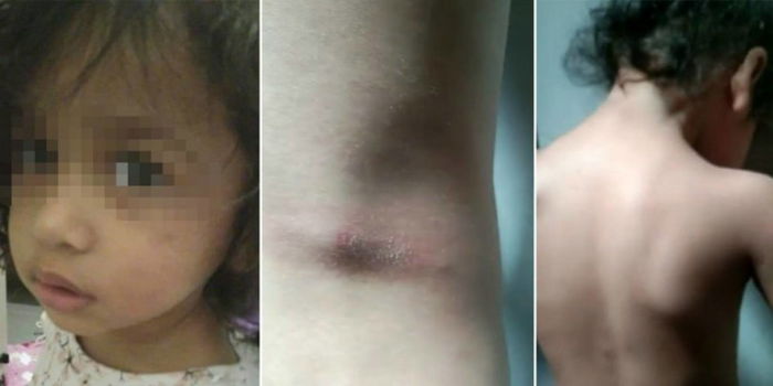 Jutawan Kosmetik Disyaki Cubit & Pukul Anak Angkat Sampai Lebam, Semata-Mata Nak Famous!