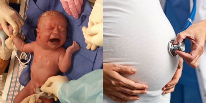 Terkejut Lihat Benjolan Cecair Di Leher Anak Semasa Lahir, Kenali Apa Itu Hygromas Cystic?