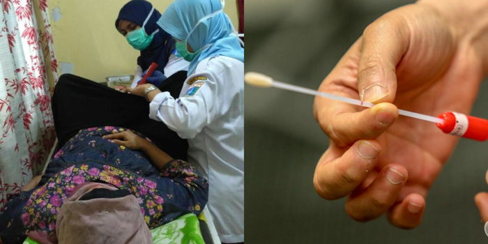 Seram Dengan Alat Muncung Itik, Tapi Kini Pap Smear Boleh Buat Sendiri Hanya Guna Cotton Bud Ini
