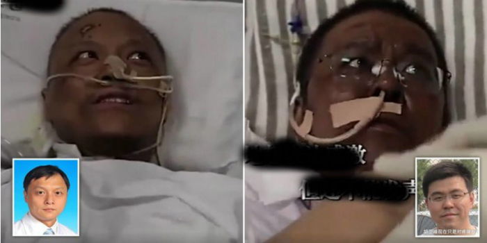 2 Doktor Positif Covid-19 Terkejut Lepas Koma Wajah Berubah Gelap, Tak Sangka Sebab Ini!