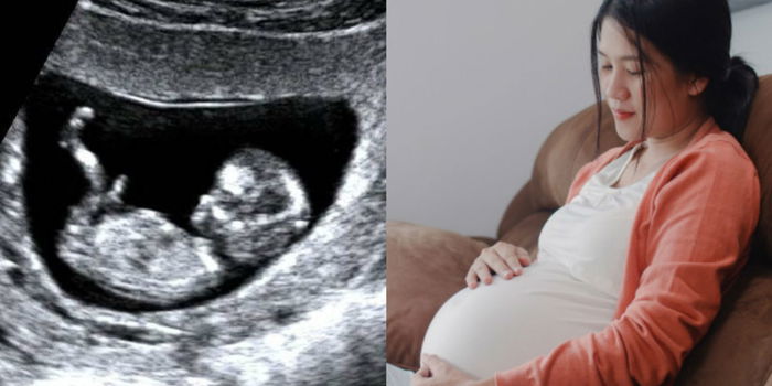 Kelahiran Mati: Bilakah Ibu Patut Risau & Perkara Yang Tidak Perlu Risau Jika Bayi Kurang Bergerak