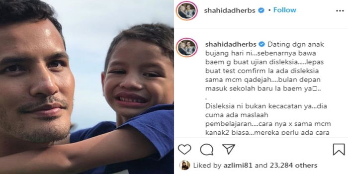 Seorang Lagi Anak Aliff Syukri Sah Hidap Disleksia, Parents Jangan Panik Kesan Tanda Ini Pada Anak
