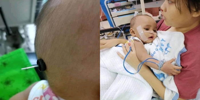 Ngeri! Besi Mainan Rosak Tembus Kepala Bayi, Penting Beli Mainan Ikut Usia Anak
