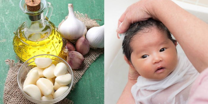 Minyak Bawang Putih Untuk Bayi, Berkesan Melegakan Batuk Berkahak & Selsema Si Manja