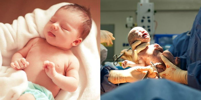 Perbezaan Kesihatan Bayi Lahir Czer Berbanding Normal, 7 Perkara Ini Ibu Ayah Perlu Tahu