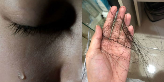 Doktor Kongsi Kisah Pesakit Merana Kanser Tahap 4, Suami Pula Tidak Izin Buat Pembedahan