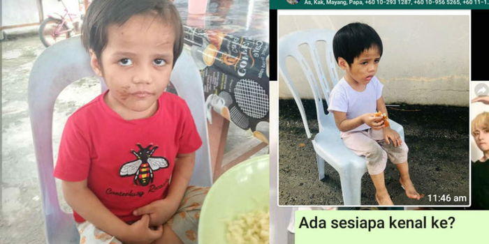 Kesiannya! Budak 5 Tahun Terbaring Di Kawasan Loji, Muka & Badan Penuh Kesan Luka