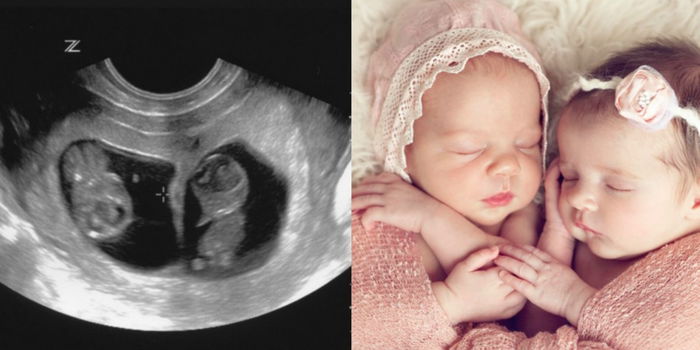 Teringin Memiliki Anak Kembar? Ini 9 Tips Buat Bakal Ibu Mengikut Saranan Pakar!