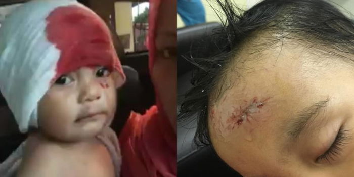 Ibu Kongsi Detik Hitam Lampu Siling Jatuh & Tertusuk Dahi Bayi Berusia 11 Bulan