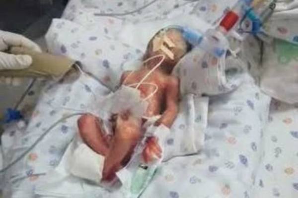 sarat hamil kembar dilanggar kereta