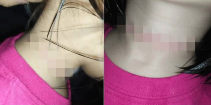 Gara-Gara Terikut Cabaran Di Tik Tok, Budak 4 Tahun Hampir Mati Cuba Gantung Diri