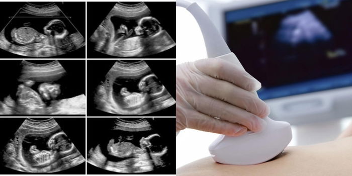 Detail Scan Banyak Kelebihannya, Ini Sebab Kenapa Anda Perlu Kumpul Duit Dan Buat!