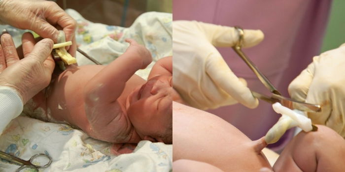 Situasi Kecemasan Ketika Bersalin: Jika Tali Pusat Terkeluar Dulu, Nyawa Bayi Dalam Bahaya