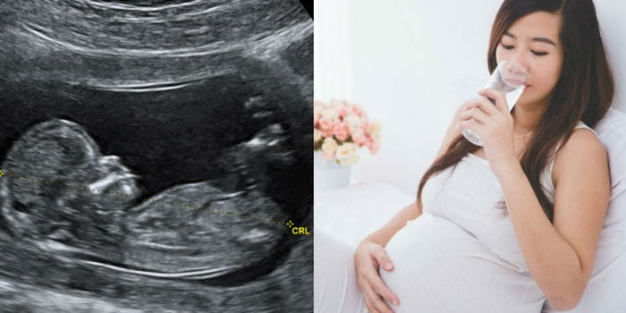 Tiap Kali Scan Bayi Selalu Sorokkan Jantina? Rahsianya Ibu Kena Minum Banyak Air Kosong!