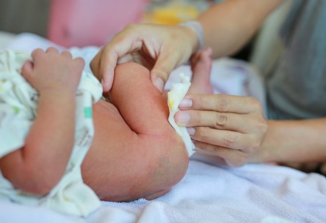 Warna Najis Bayi Berlendir Kuning, Adakah Ia Normal Atau Perlukah Ibu Risau?