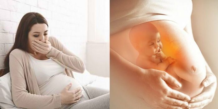 Kerap Gastrik Ketika Hamil Adalah Normal, Ia Petanda Bayi Anda Semakin Membesar!