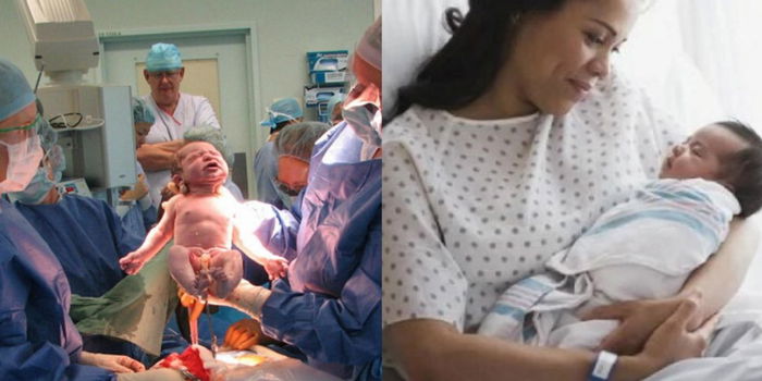 Pakar Kongsi Waktu Yang SELAMAT Untuk Hamil Lagi Setelah Caesar, Ibu Sila Take Note!