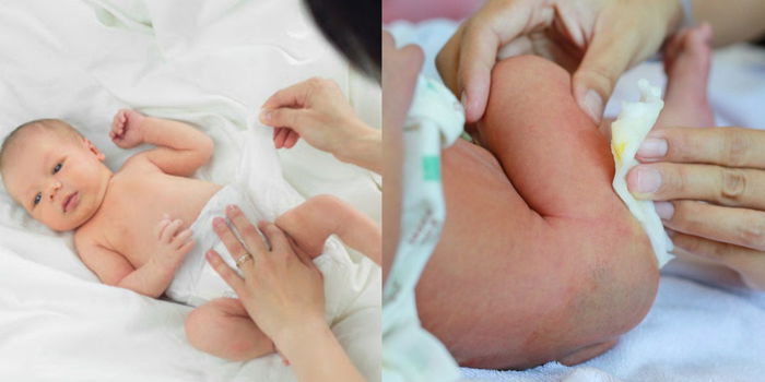 Bila Punggung Bayi Melecet Akibat Cirit-Birit, Ibu Elakkan Guna Tisu Basah Atau Sabun!