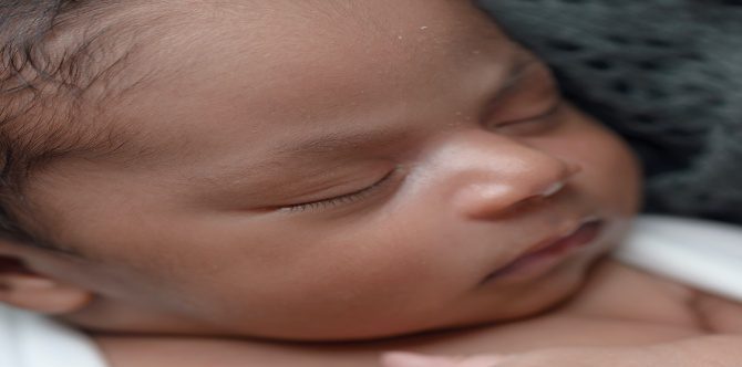 Eh, Baby Pun Ada Jerawat? Ini Perkara Penting Yang Ibu Bapa Perlu Tahu