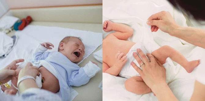 Cara Penjagaan Selepas Berkhatan Bayi Lelaki & Perempuan, Luka Sunat Cepat Sembuh