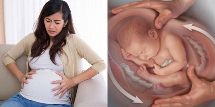 Bila Anak Songsang Dalam Perut, Adakah Boleh Pusing Semula @ Kena Bersalin Caesar?
