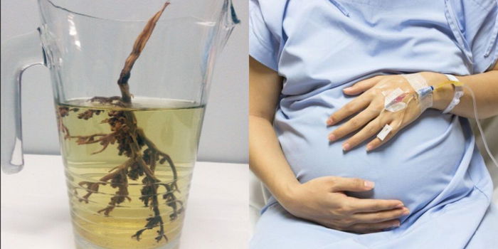 Minum Air Kacip Fatimah Untuk Mudah Bersalin, Rahim Ibu Ini Pecah & Janin Meninggal Dunia