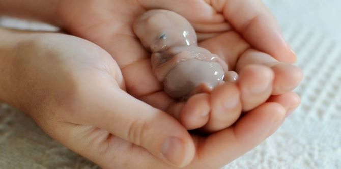 Wanita Mempunyai Pangkal Rahim Lemah, 8 Kali Keguguran & Kini Hamil, Ini Sebabnya