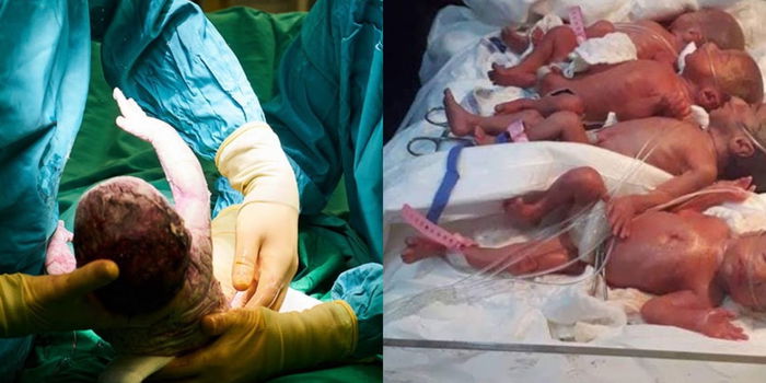 Bagaikan Tidak Percaya, Wanita 25 Tahun Ini BERJAYA Melahirkan Bayi Kembar Sembilan