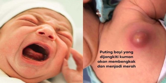 Pernah Dengar Petua Suruh Picit Puting Baby? Tolong Jangan Buat, Bahaya Untuk Bayi Anda: Doktor