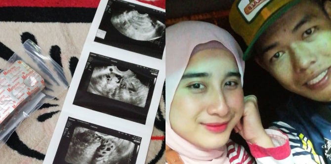 ''Ada PCOS Tak Mustahil Boleh Mengandung,'' Wanita Ini Kongsi Amal Al-Fatihah 41 Kali