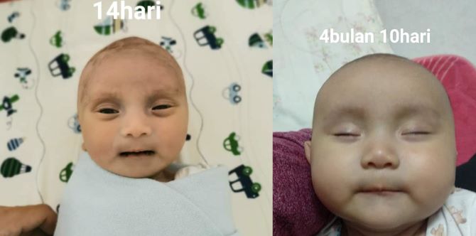 Tak Menyangka Susu Badan Tiada, Bayi Baru Lahir Rupanya Kelaparan Selama 14 Hari, Ibu Baru Tolong Alert