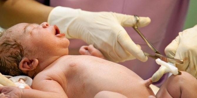 Bayi Yang Tali Pusatnya Sengaja Lewat Dipotong Ketika Lahir Jarang Sakit, Sistem Imun Kuat