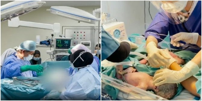 4 Tahun Menanti Zuriat, 2 Kali Keguguran, Akhirnya Tangisan Kembar 4 Gamatkan Bilik Pembedahan!