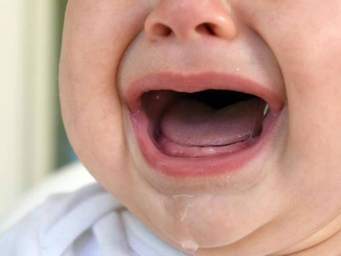 Teething 101: A Complete Guide - Here's What Parents Need to Know!