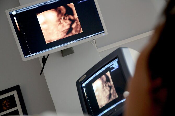 All You Need To Know About Spotting During Pregnancy