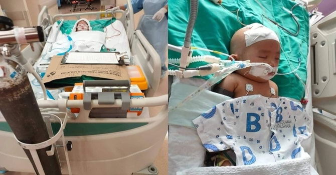 Bayi 7 Bulan Dihempas Berkali-Kali Ke Lantai Oleh Pengasuh Kritikal, Retak Tempurung Kepala!