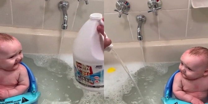 Tak Hirau Anak Menangis, Ibu Tegar Mandikan Anak Guna Peluntur! Betulkah Boleh Rawat Ekzema?