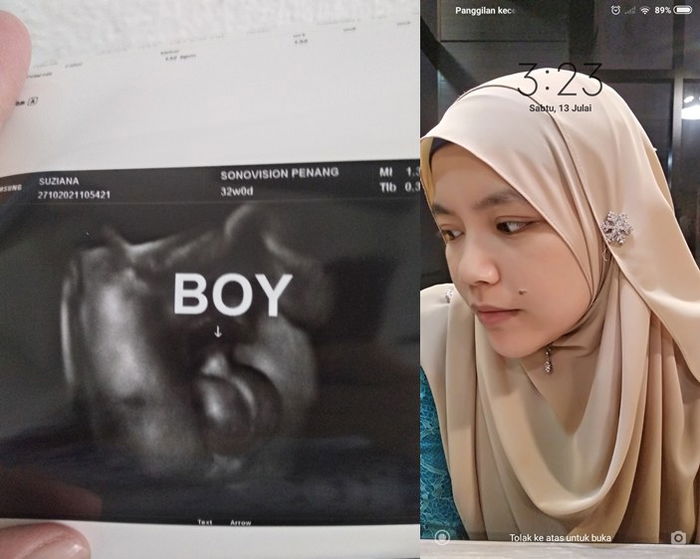 Naluri Ibu Ini Kuat Mengatakan Dia Hamil, Walaupun Kiraan Haidnya Tidak Teratur!