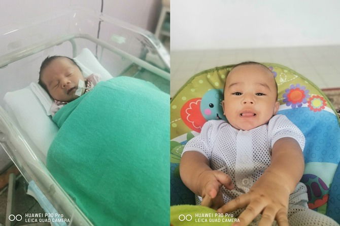 Walaupun Anaknya Baby Pramatang & Kuning, Ibu Ini Tabah Hadapi Cabarannya!