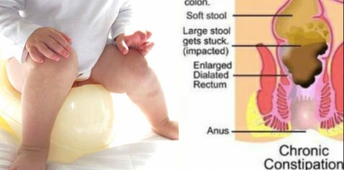 Tabiat Pemakanan Seharian Punca Utama Kanak-Kanak Sembelit, Ini Tips Buat Ibu Ayah!