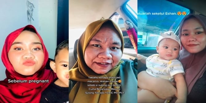 Dua Kali Hamil Muka Berkedut & Berubah Jadi Tua, Wanita Bersyukur Suami Tetap Setia
