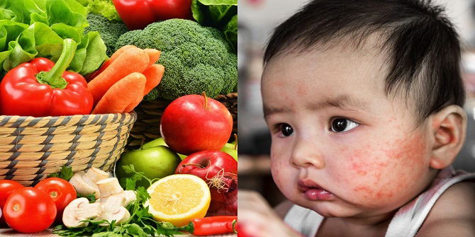 3 Musuh Utama Dalam Sayur Yang Boleh Buat Ekzema Anak Jadi Teruk, Ibu Sila Elakkan!