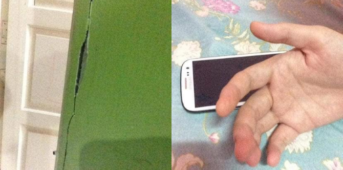 ''Nasib Baik Tak Arwah,'' Wanita Melambung, Telefon Disambar Petir Ketika Sedang Cas