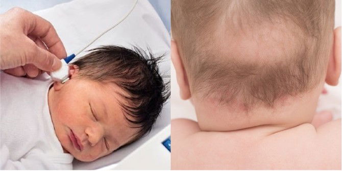 Rambut Bayi Gugur & Nipis Selepas Bercukur, Bilakah Ia Akan Tumbuh Lebat?