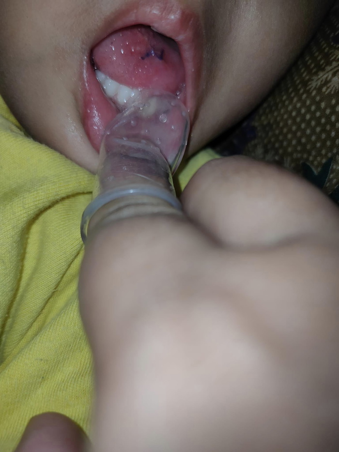 anak jatuh tersembam