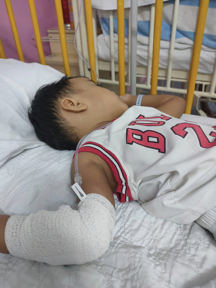 anak jatuh gelongsor